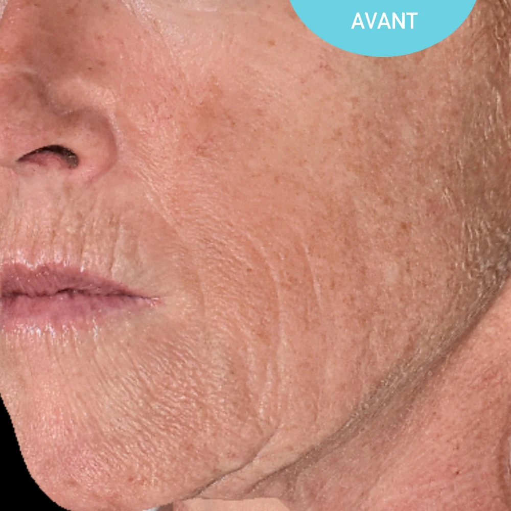Sérum Anti-Âge - Image 3